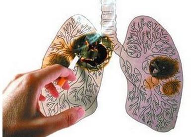 肺结节与肺癌有何关联