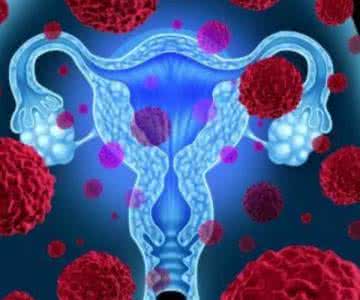 卵巢癌是如何扩散的?